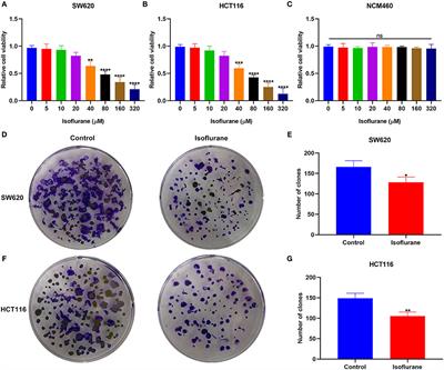 Isoflurane Suppresses Proliferation, Migration, and Invasion and Facilitates Apoptosis in Colorectal Cancer Cells Through Targeting miR-216